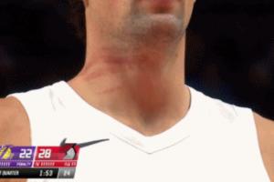 好狠！斯玛特防守阿夫迪亚 一巴掌给后者脖子上挠出数道血痕